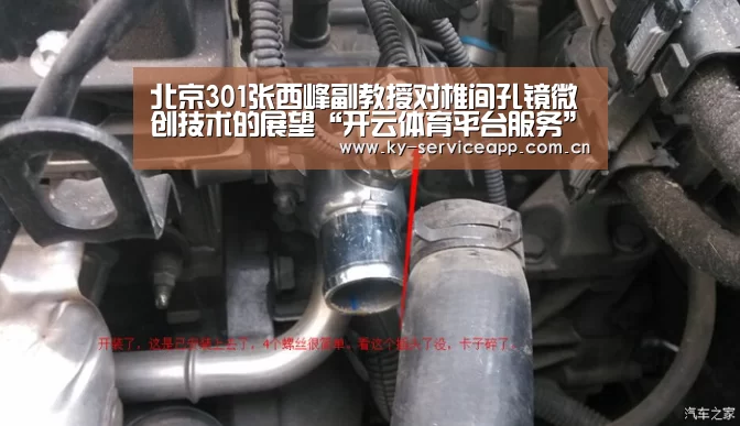 北京301张西峰副教授对椎间孔镜微创技术的展望“开云体育平台服务”