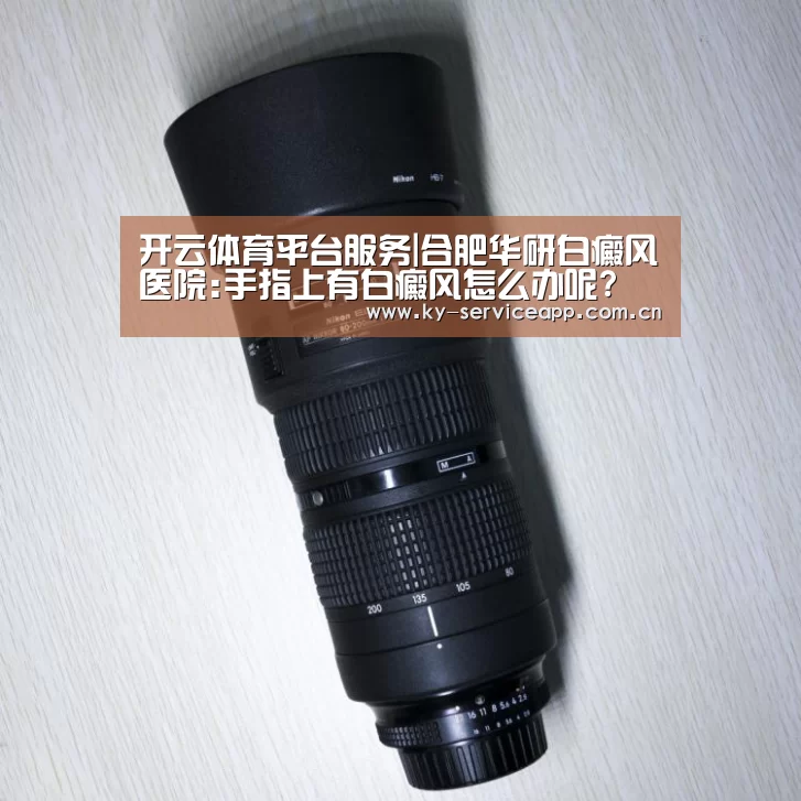开云体育平台服务|合肥华研白癜风医院:手指上有白癜风怎么办呢?